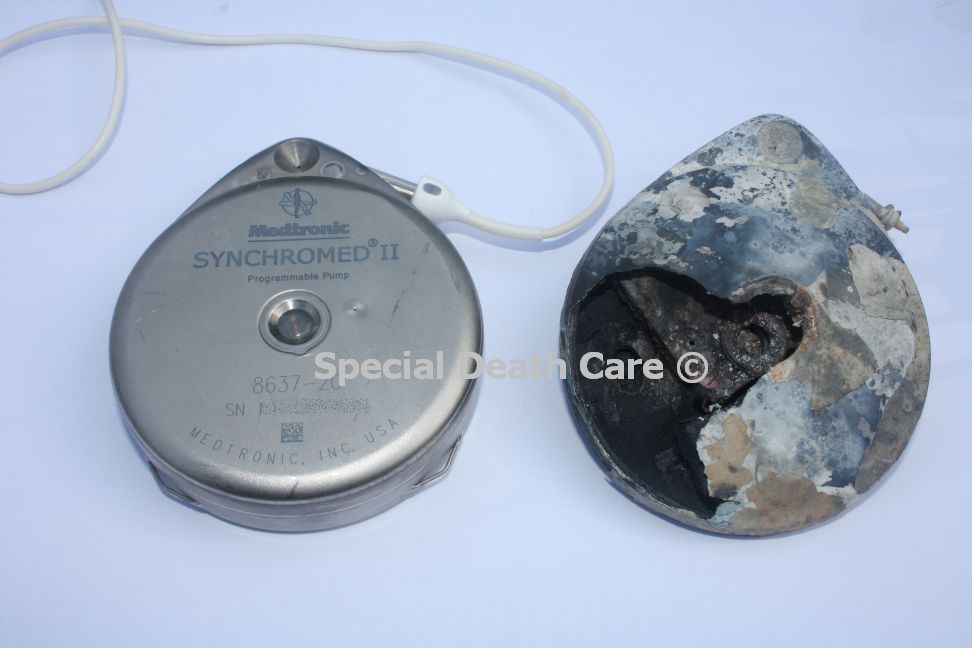 Explosie gevaar pacemakers en medicijnpompen